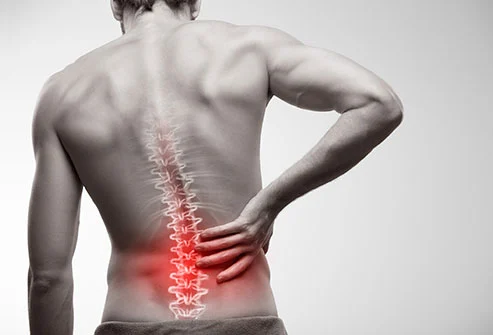 The Painful Truth of Back Pain